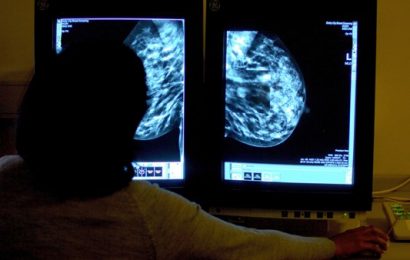 Study Shows Hundreds Could Avoid Chemotherapy for Breast Cancer