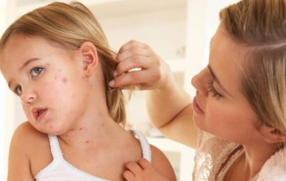 Number of Measles Cases in Ireland Jump 244%
