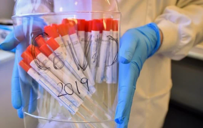 Belfast Researchers Trial Cell Therapy Treatment for Coronavirus Patients