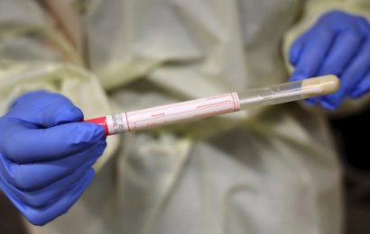 Taoiseach Acknowledges Possible Delays in Coronavirus Testing
