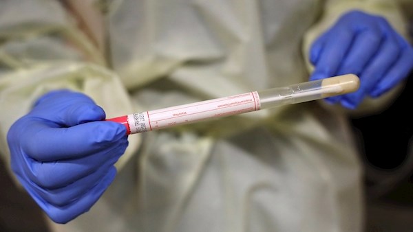 Taoiseach Acknowledges Possible Delays in Coronavirus Testing