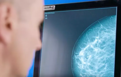 Artificial Intelligence To Support Breast Cancer Screening In Ireland
